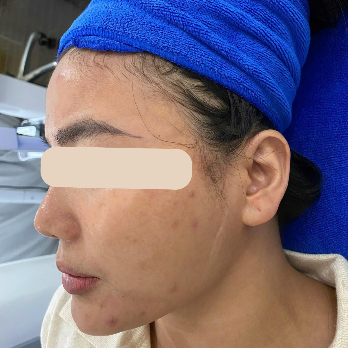 Before image