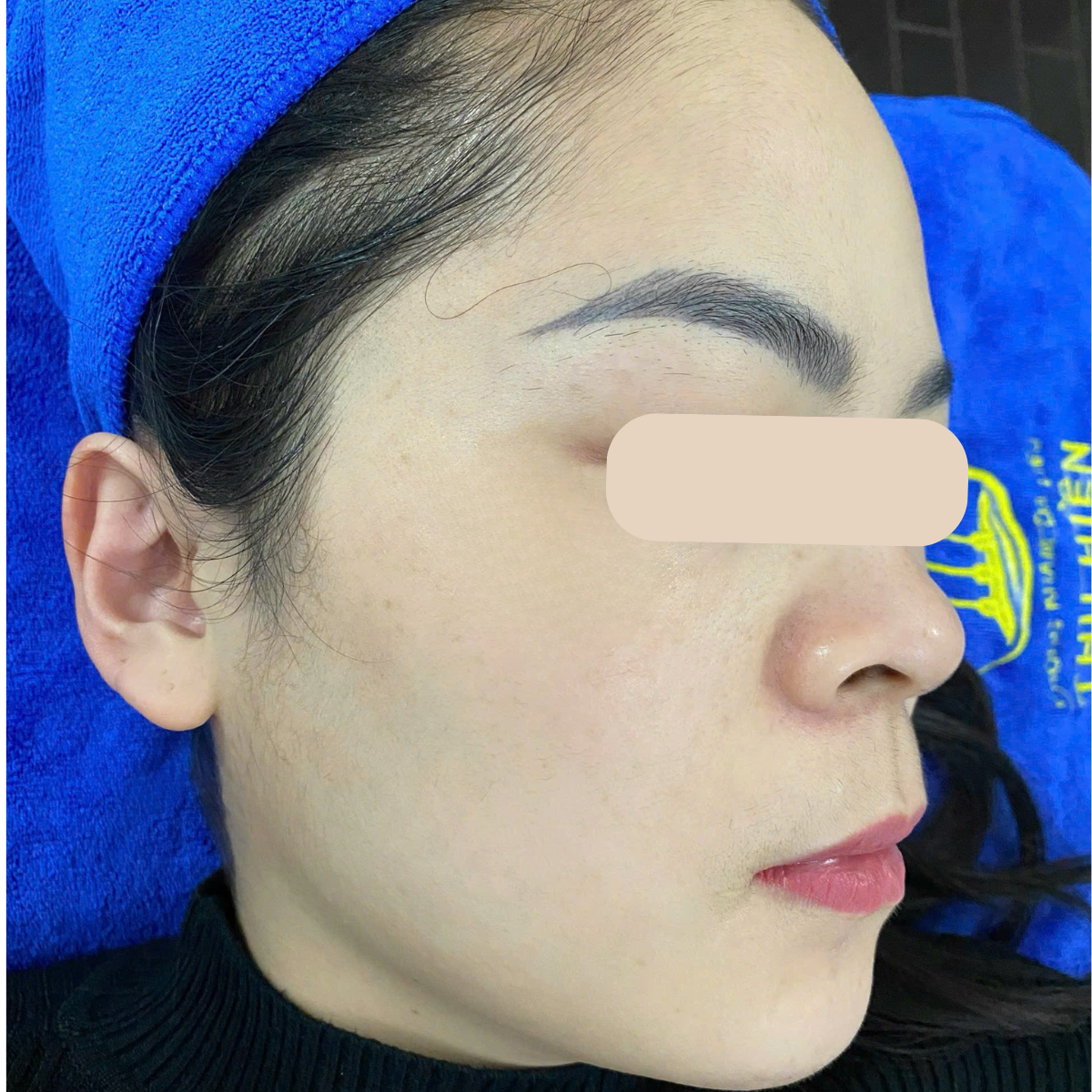 After image