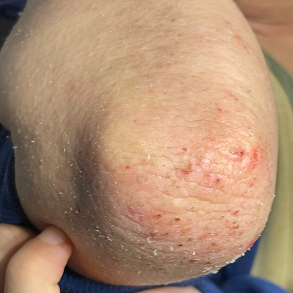 Before image