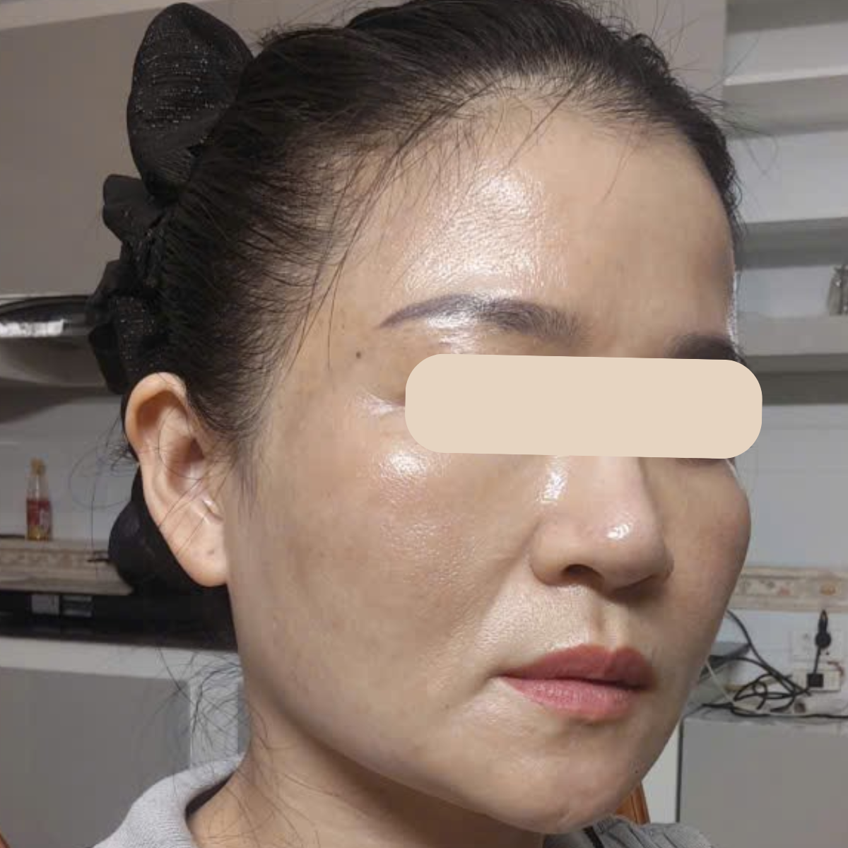 After image