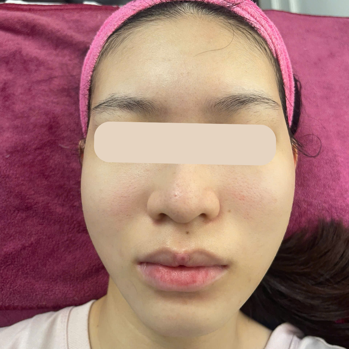 After image