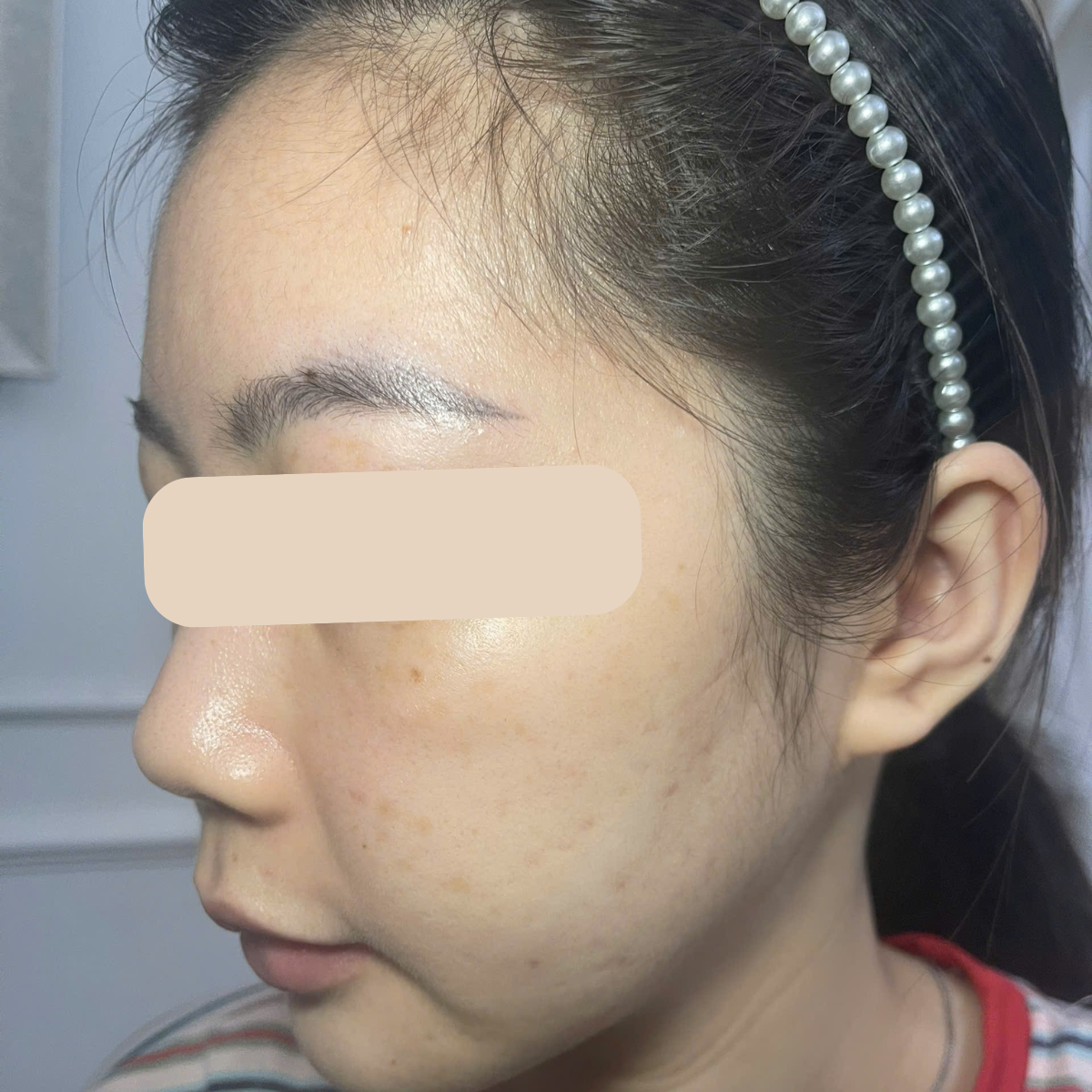After image