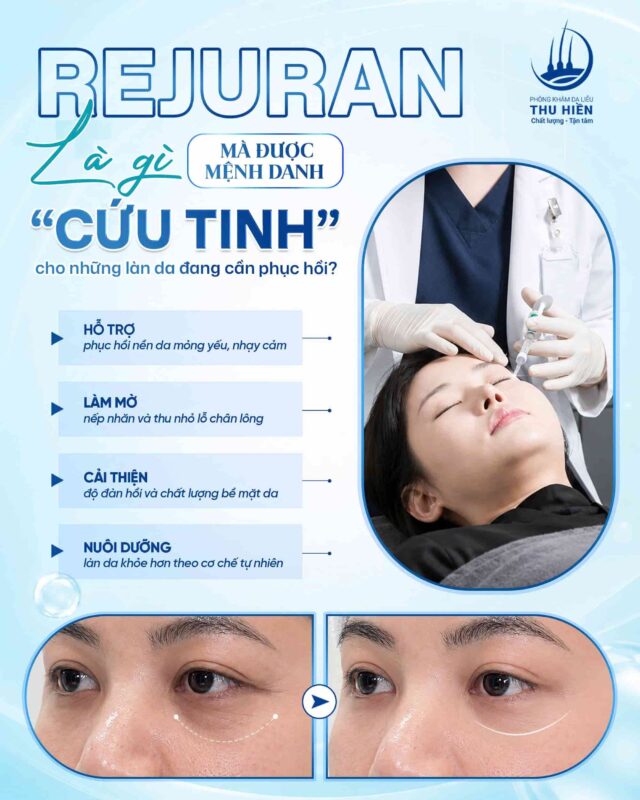 Rejuran là gì mà được mệnh danh là “cứu tinh” cho những làn da đang cần phục hồi?
