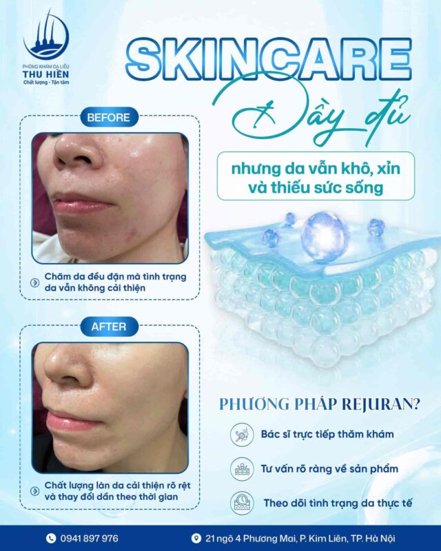 Skincare đầy đủ nhưng da vẫn khô, xỉn và thiếu sức sống? Khi nào có thể cân nhắc Rejuran?